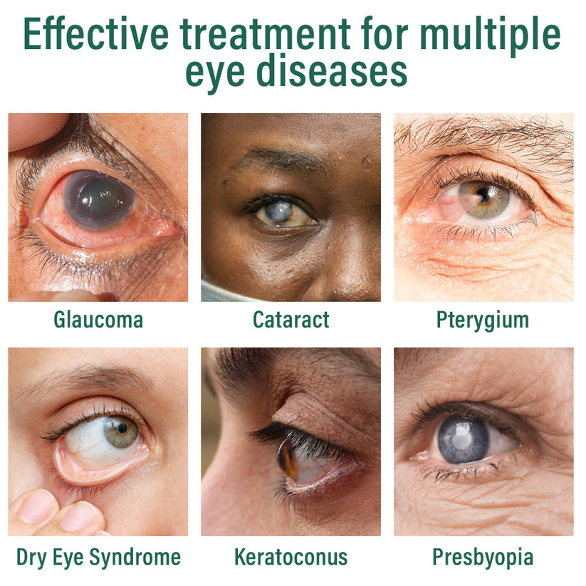 Nano Eye Drops Serum đŠââď¸Suitable for presbyopia, dry eye syndrome, glaucoma, and cataracts đŚ