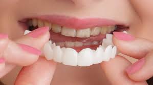 Last Day Sale 49% OFF🔥Artificial Teeth/ silicon braces/ Artificial teeth