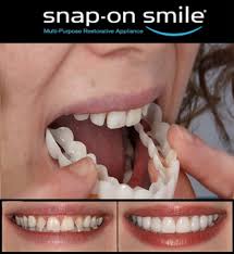 Last Day Sale 49% OFF🔥Artificial Teeth/ silicon braces/ Artificial teeth