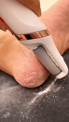✨ Electric Foot File | Dead Skin Remover Tool 🌟 USB Rechargeable, 2 Interchangeable Heads | Must-Have Foot Care 💅👣