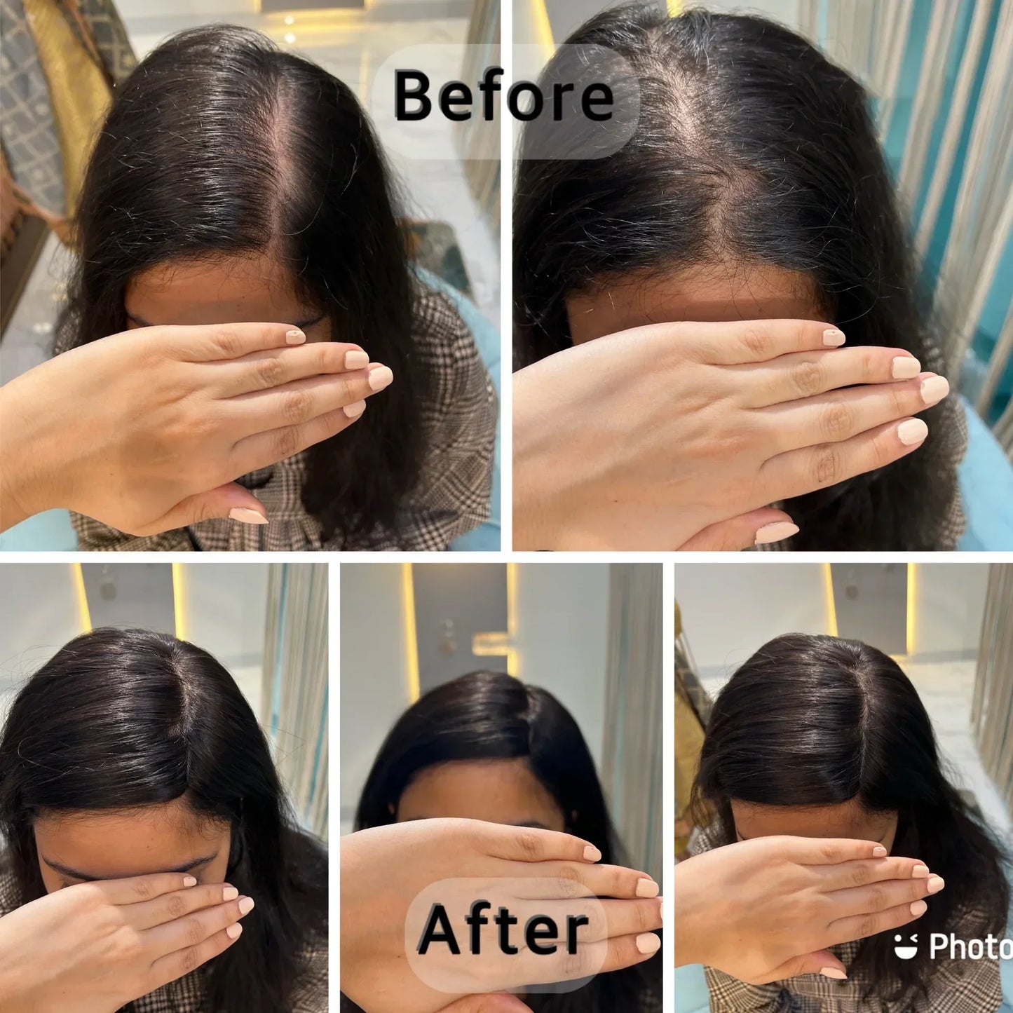 【🔥HOT SALE】2x3 Mini Scalp Topper | Hair Topper For Crown Thinning | Natural Look Wig