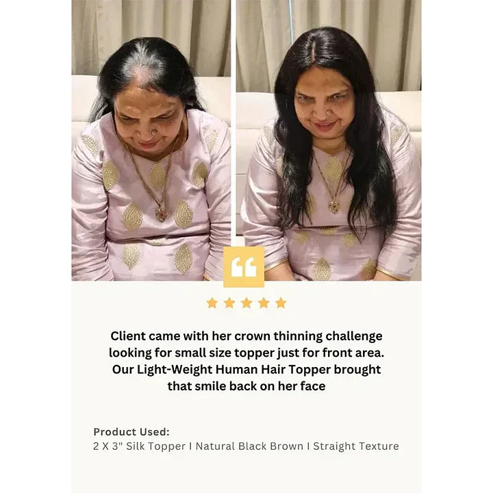 【🔥HOT SALE】2x3 Mini Scalp Topper | Hair Topper For Crown Thinning | Natural Look Wig