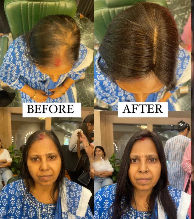 【🔥HOT SALE】2x3 Mini Scalp Topper | Hair Topper For Crown Thinning | Natural Look Wig