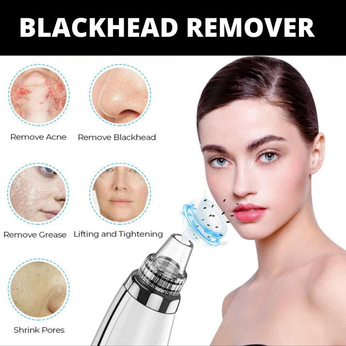 ⏳ Limited time 50% off! 💥5-in-1 Rechargeable Blackhead Remover