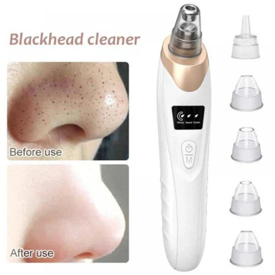 ⏳ Limited time 50% off! 💥5-in-1 Rechargeable Blackhead Remover